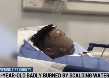 Georgia Boy Suffers Severe Burns After Friends Dump Scalding Water on Him During Sleepover 'Prank'